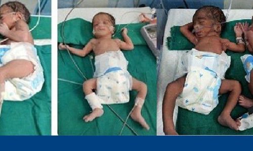 पोखरामा एक युवतीले जन्माइन चम्ल्याहा शिशु