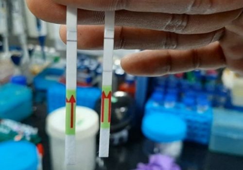 पिसिआर ढिलाहुँदा एन्टीजीन परिक्षण बढाउँदै स्थानीय तह