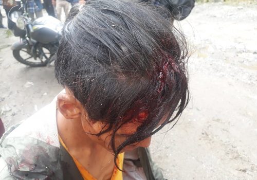ढुङ्गाले लागेर मोटर साईकल चालक घाईते